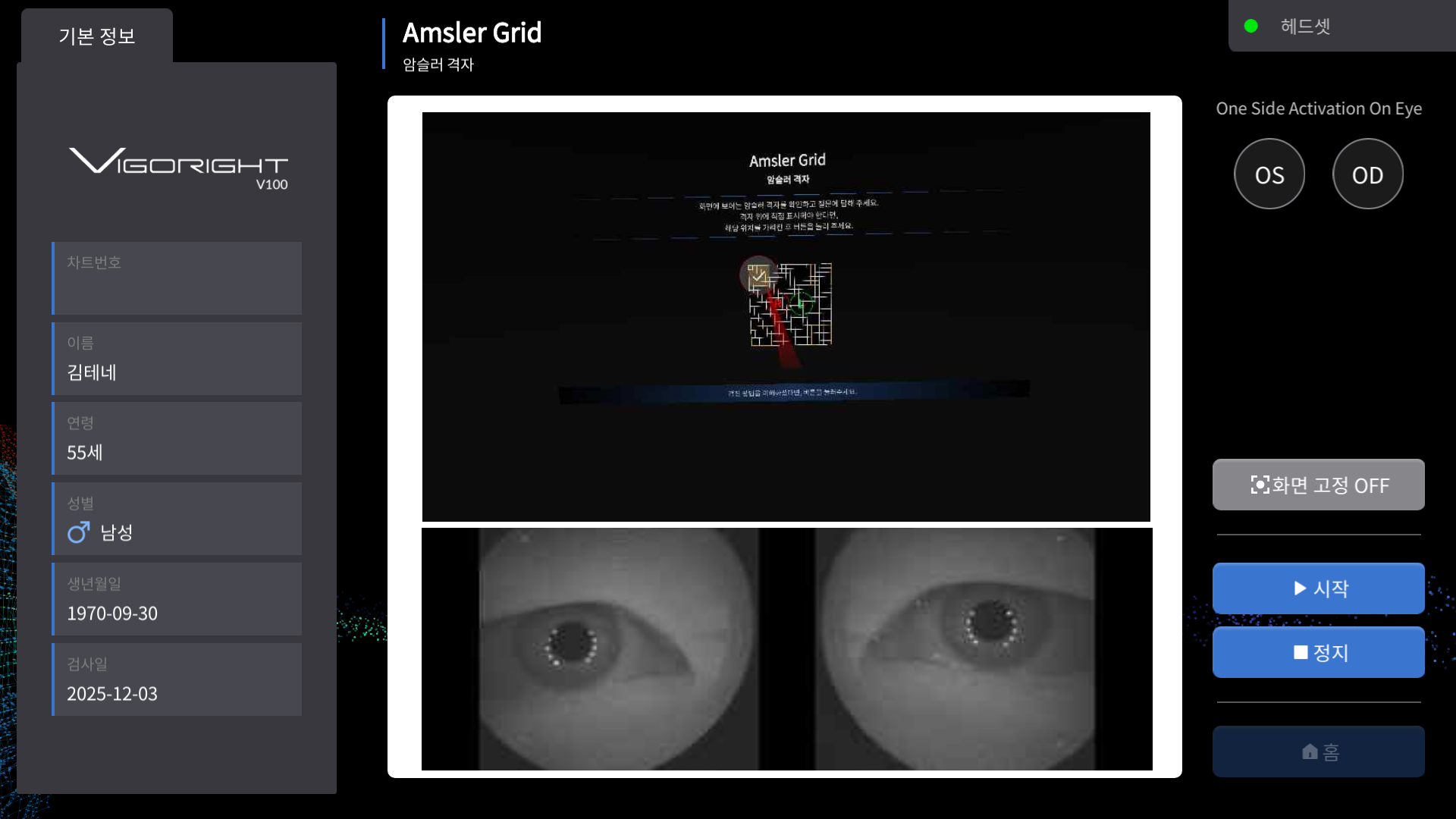 암슬러격자(Amsler Grid)